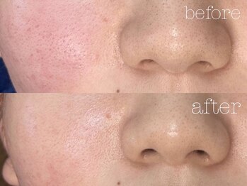 ロイ 初生店(LOI)/プラズマ