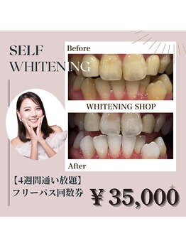 ホワイトニングショップ 恵比寿店/通い放題【事前予約で¥30000】