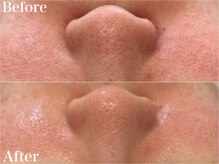 プライベートサロン ラウレア(Laule'a)/クリスティーナ/ビオフィート