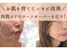 ミュー 岡崎店(mieux)の雰囲気（★毛穴洗浄＆プラセンタの効果で施術直後から効果実感！！）
