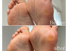 カシェット 広島店(Cachette)/50代女性☆足裏角質ケア60分