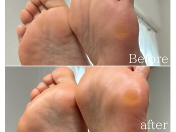 カシェット 広島店(Cachette)/50代女性☆足裏角質ケア60分