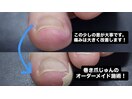 少しの変化で痛みが大きく改善!