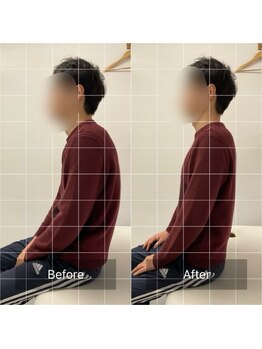 ナオル整体 池袋院(NAORU整体)/骨盤矯正の施術前後