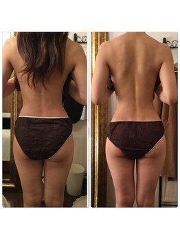 ラベルヴィ(La belle vie)/結果重視・痩身エステのお客様