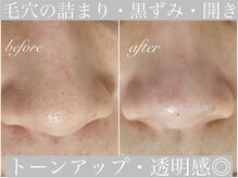 アリスビューティー(AliceBeauty)
