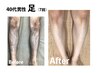 【夏はもうすぐ！】全身脱毛（VIO無）　16,000円⇒12,000円