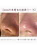【2周年☆】効果実感!毛穴引き締め肌ツヤup☆毛穴w洗浄¥9900→¥6900