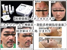 田舎家ほぐし処 ひまわり
