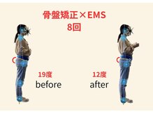 リボーン(REBORN)/整体/骨盤矯正/EMS