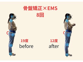 リボーン(REBORN)/整体/骨盤矯正/EMS