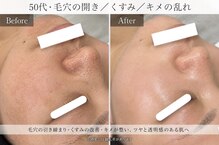 サロン ド ビューティージュエル(salon de beauty JEWEL)