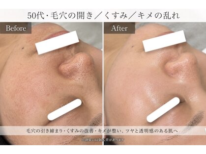 サロン ド ビューティージュエル(salon de beauty JEWEL)の写真