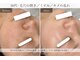 サロン ド ビューティージュエル(salon de beauty JEWEL)の写真