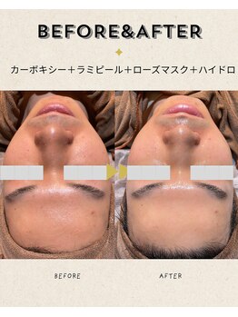 ケーナインエッセ(K9 esse)の写真/韓国で話題！エイジングケアができる次世代低刺激ピーリング！肌に美容成分をラミネートした様な艶肌に。