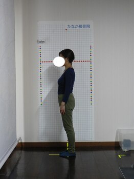 四日市たなか接骨院/【流れ4】 写真で姿勢チェック