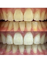 イイハキューブ(e8 cube)/before & after