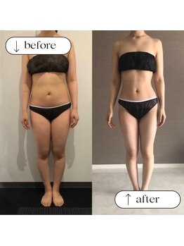 トータルビューティーサロンリア(Li'a)/ビフォー＆アフター