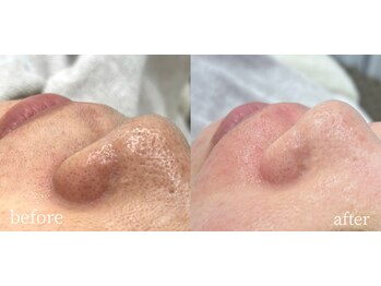 フォーカス(FOCUS)/艶肌wax