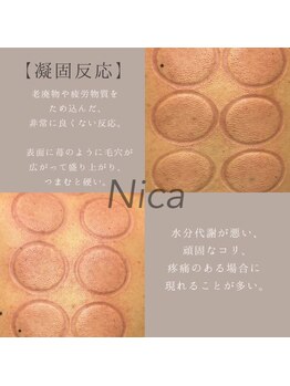 ニカ(Nica)/【凝固反応】