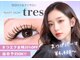 トレース(tres)の写真