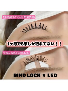 バタフライジュエル 広島店(ButterflyJewel)/LED×バインドロックモチ最強！