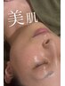 【日焼け後の美白ケアに】小顔艶肌ボンバーフェイシャル120分¥15,000→