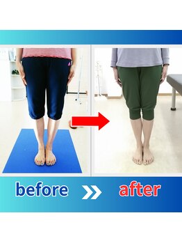 ストレッチヒーロー 倉吉店(STRETCH HERO)/O脚、X脚