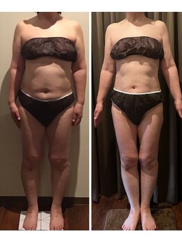 ルアン 八千代台店(Ruang)/お客様ビフォーアフター