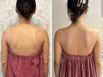 ロココ 新宿店(Rococo)の写真