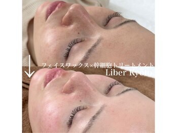 リベルキョウト 京都駅前店(Liber Kyoto)/艶美白!レチノール/幹細胞パック
