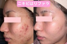 リファラ 光の森店(REFALA)