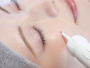 アイリープ(eyeleap)の写真/隠さないシミケア！専用マシンでシミのある場所に狙い撃ち＋速攻小顔筋膜リフトで透明感溢れる素肌美人へ☆
