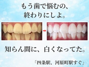 ホワイトニングショップ 四条店