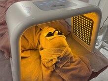 リリベル(LilyBell)/OMEGAPDT(黄色)