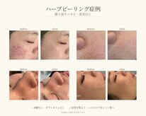 ベル 辻堂(Belle)