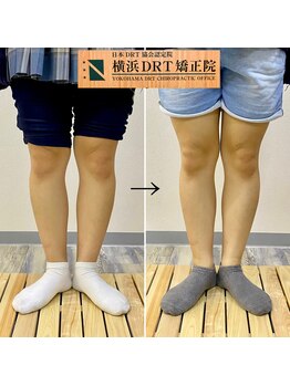 横浜DRT矯正院/O脚矯正