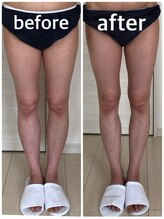 サロンドルフレ(salon de Reflet)/半身トリートメント