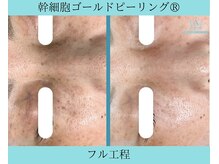 リメイククリニカルビューティー(Remake clinical beauty)/あきらめないで