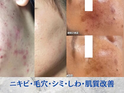 エステティックス ナインワンワン 横浜(Esthetics911) の写真