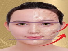 ホロホロ(holoholo)/ゾンビパック