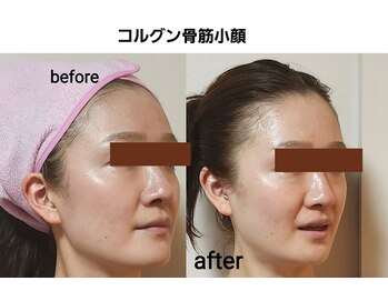 セレブリティ(Celebrity)/コルギ