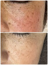 ギャラクシービューティー(galaxy beauty)/