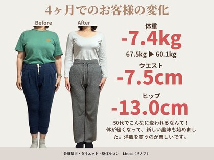 リノア(Linoa)の写真