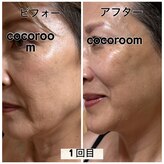 リフレッシュア ココルーム(CoCo room)