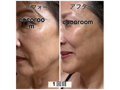リフレッシュア ココルーム(CoCo room)の写真