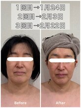 ルポアン(Repos an)/SNS話題のレモンボトル！