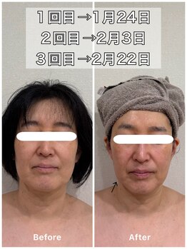 ルポアン(Repos an)/SNS話題のレモンボトル!