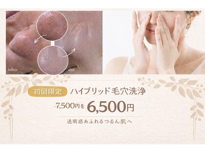 サーラ(SA-RA)の写真