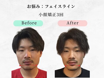 美容整体ウェリナ 中川八田院/小顔矯正/骨盤矯正/痩身整体